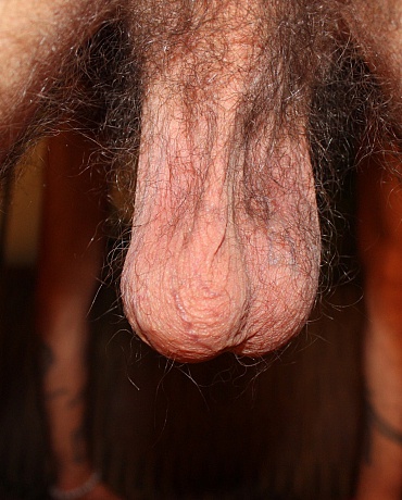 Hairy All Over!