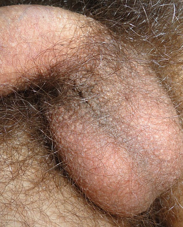 Holy Hairy Nutsacks!